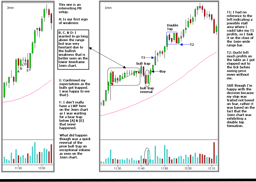 pullback specialist
