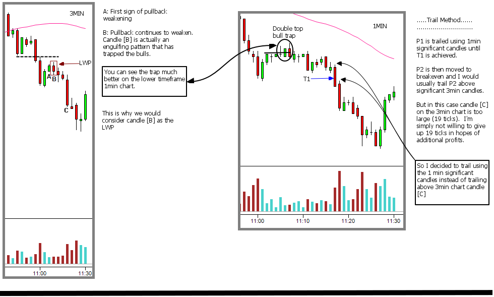 pullback specialist
